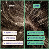 Exfoliating Shampoo For Loose Dandruff Flakes Tea Tree & Salicylic Acid 70g